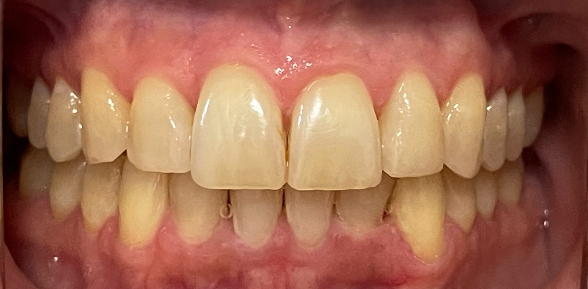 Crestview Family Dental Crestview Family Dental