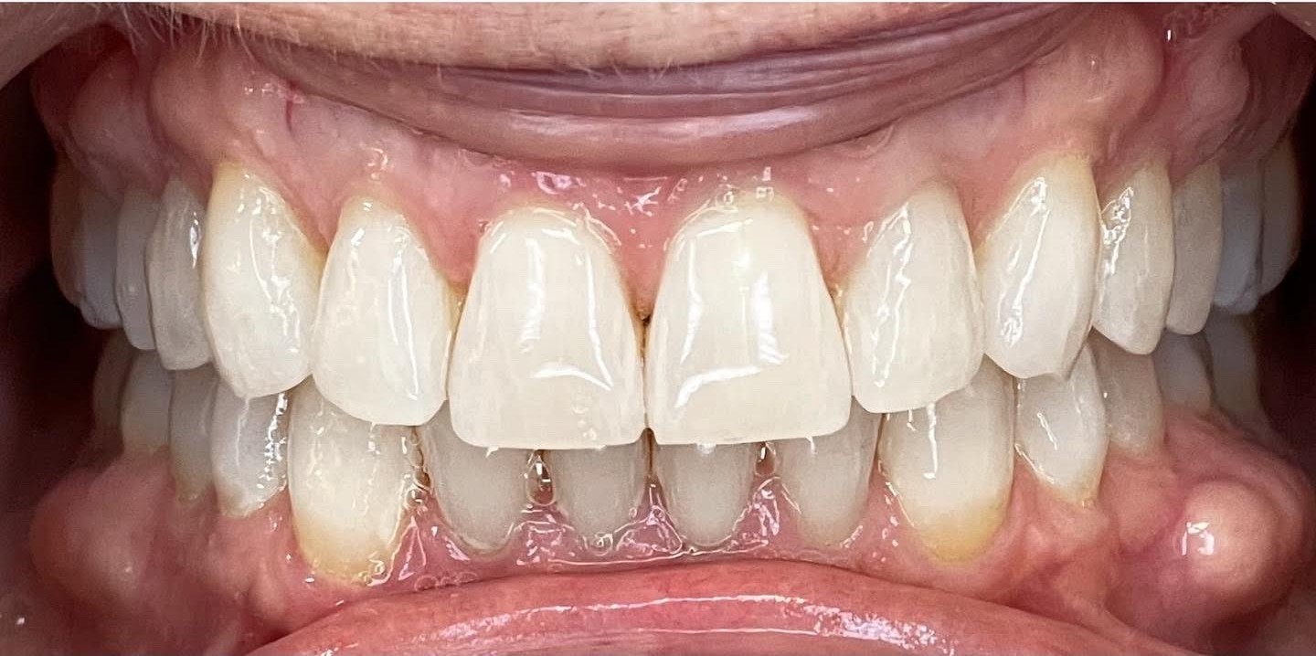 Crestview Family Dental Crestview Family Dental