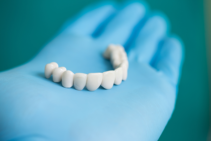 Restoring Your Smile with Dental Bridges in Santa Clara, CA Restoring Your Smile with Dental Bridges in Santa Clara, CA