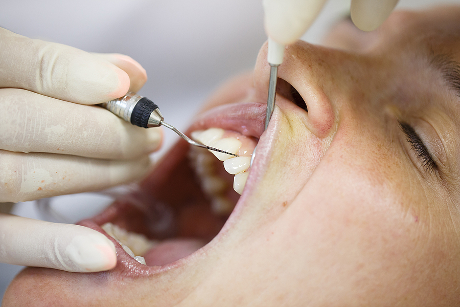 Effective Solutions for Gum Health: Periodontal Treatment in Santa Clara, CA