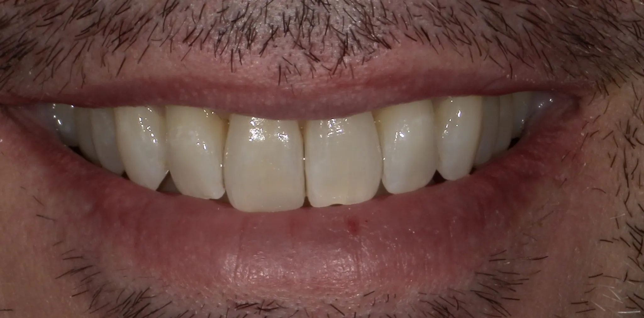 Crestview Family Dental