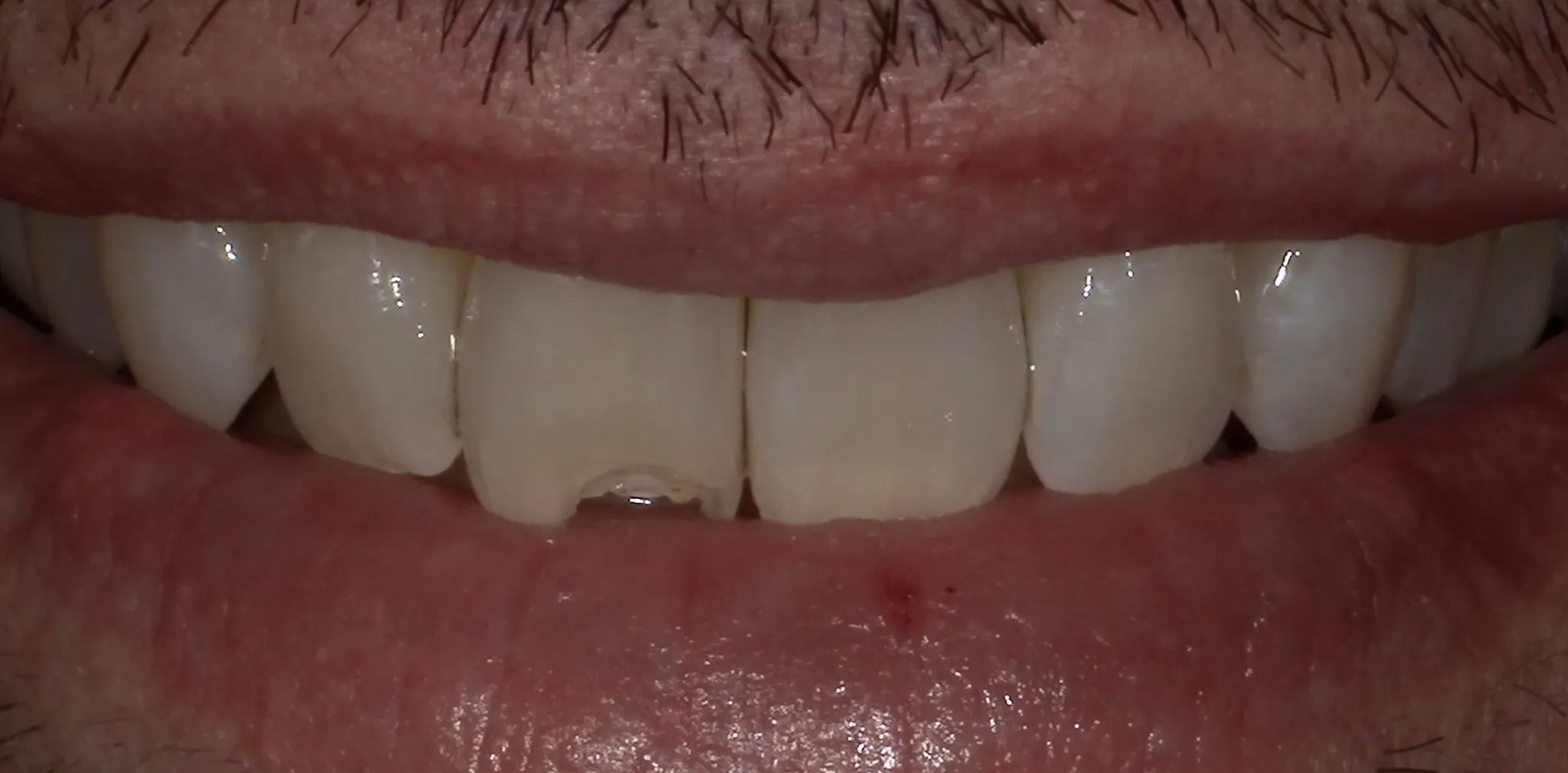 Crestview Family Dental