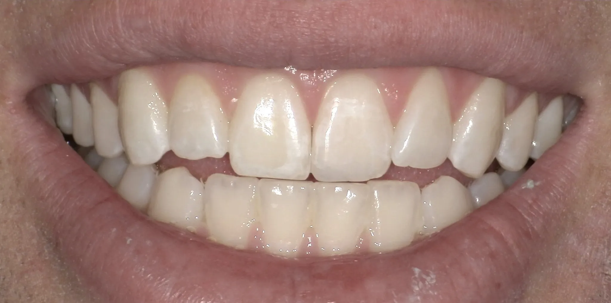 Crestview Family Dental