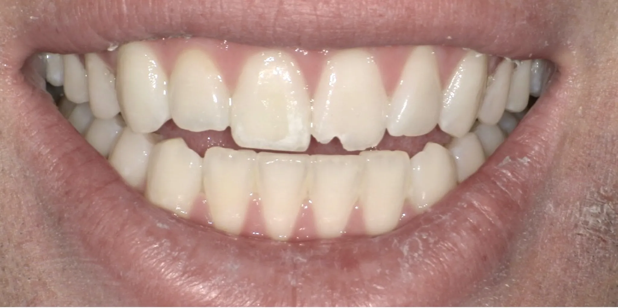 Crestview Family Dental