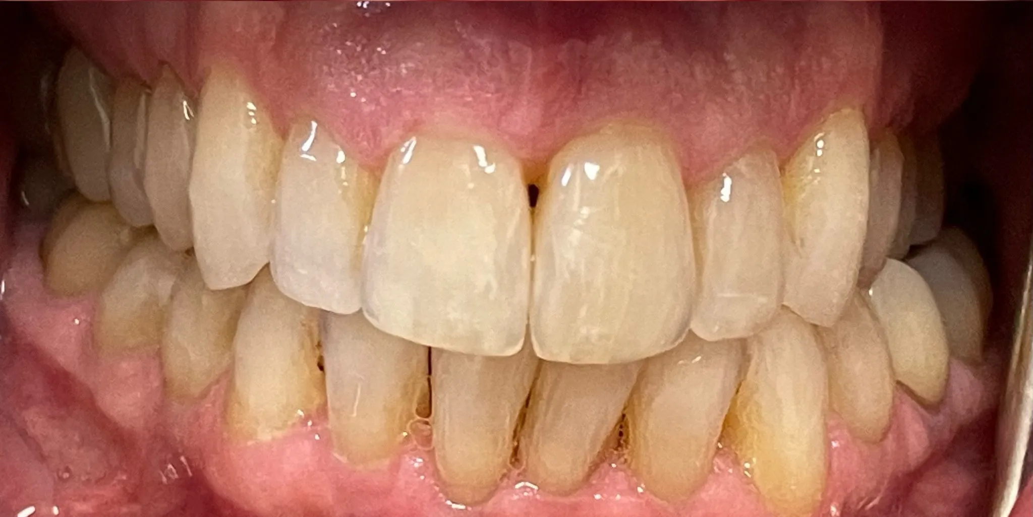 Crestview Family Dental