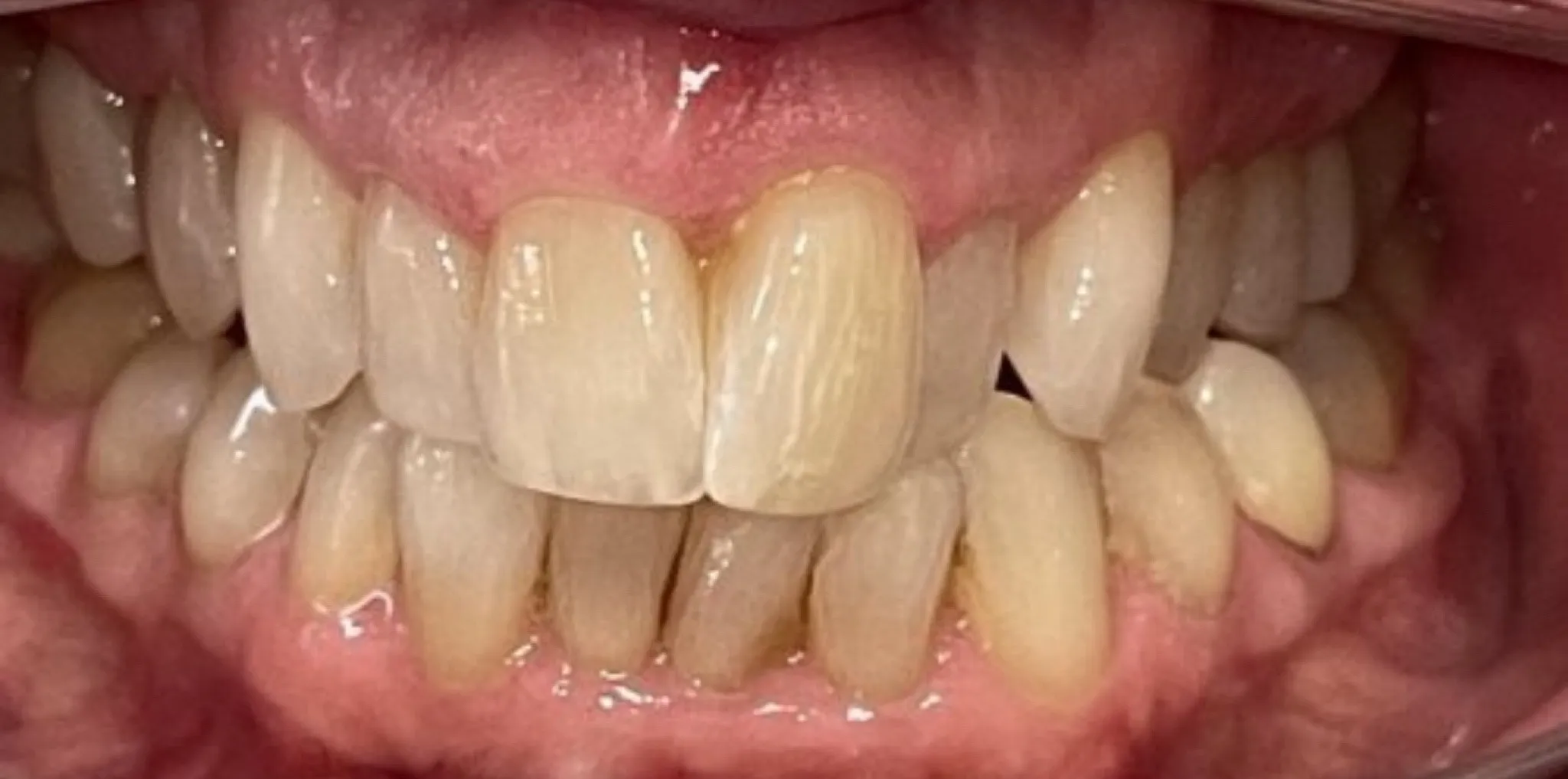 Crestview Family Dental