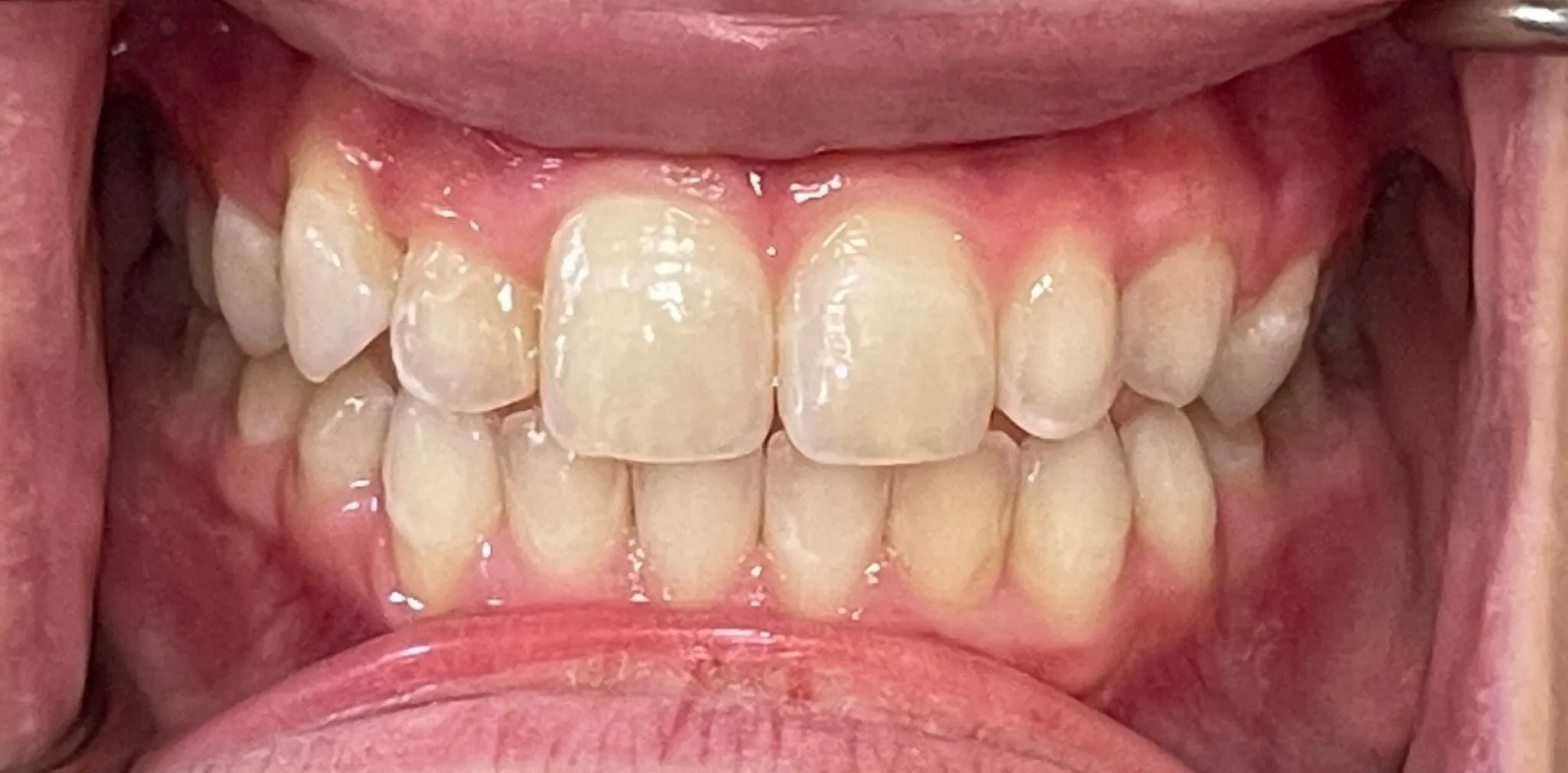 Crestview Family Dental