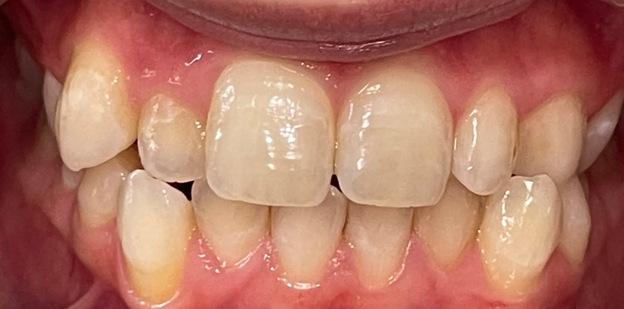 Crestview Family Dental