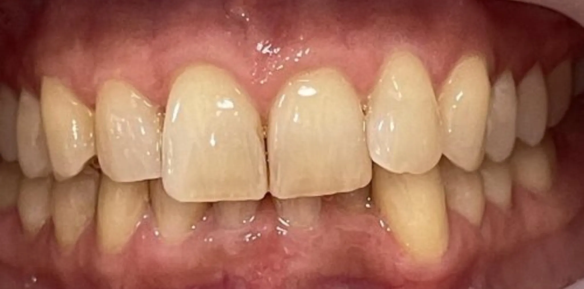 Crestview Family Dental