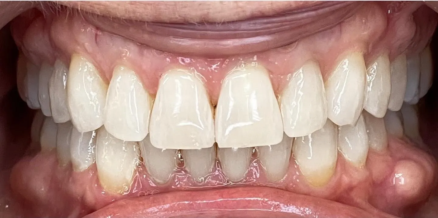 Crestview Family Dental