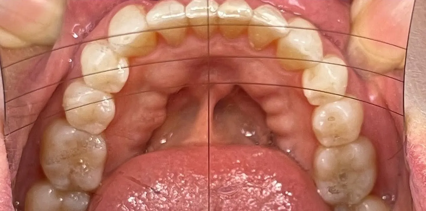 Crestview Family Dental