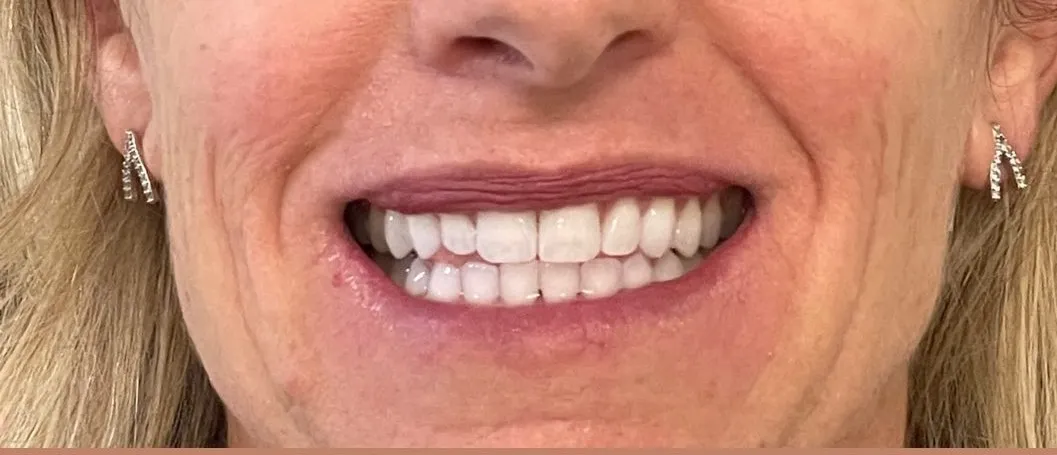 Crestview Family Dental