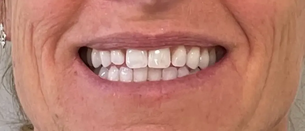 Crestview Family Dental