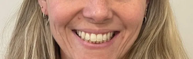 Crestview Family Dental