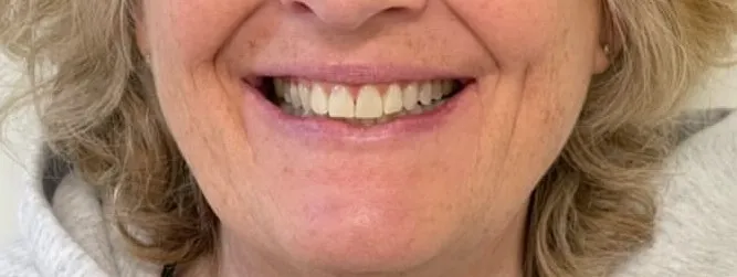 Crestview Family Dental