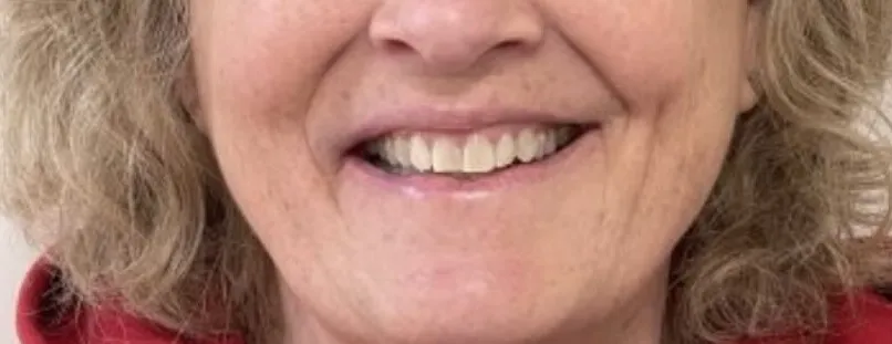 Crestview Family Dental