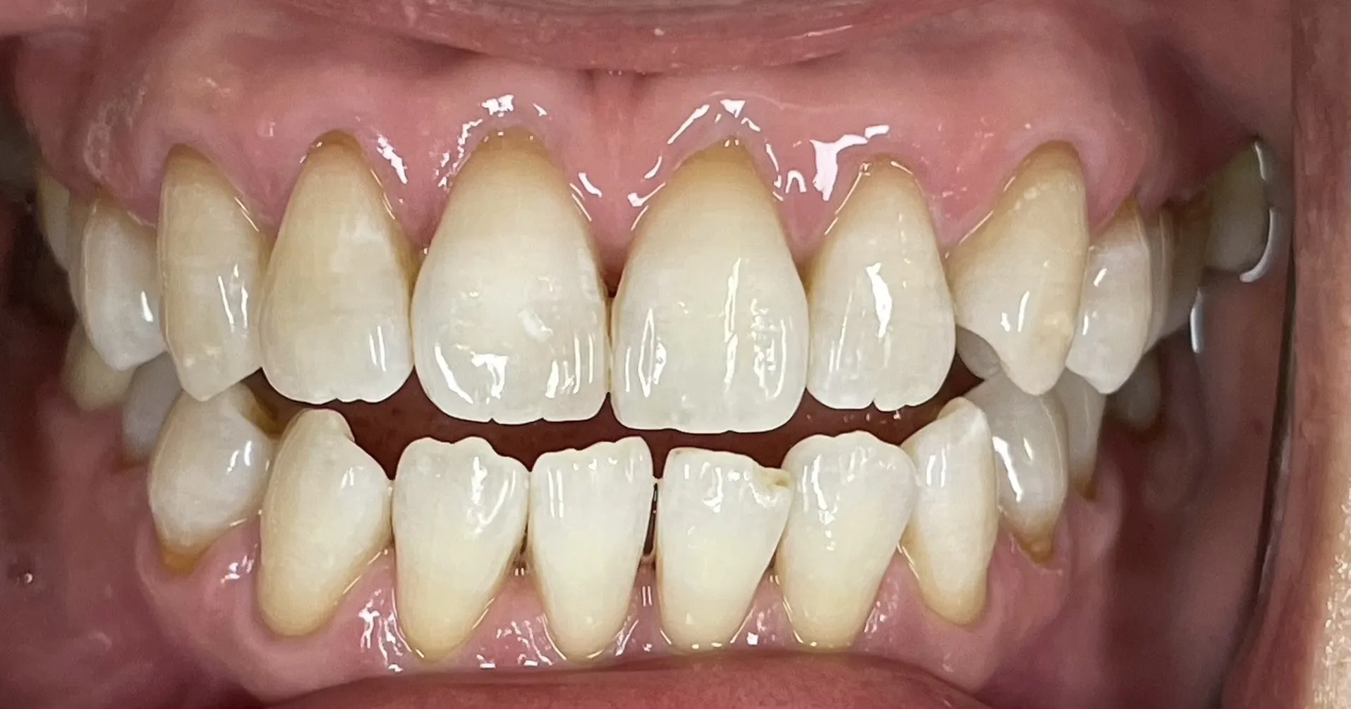 Crestview Family Dental