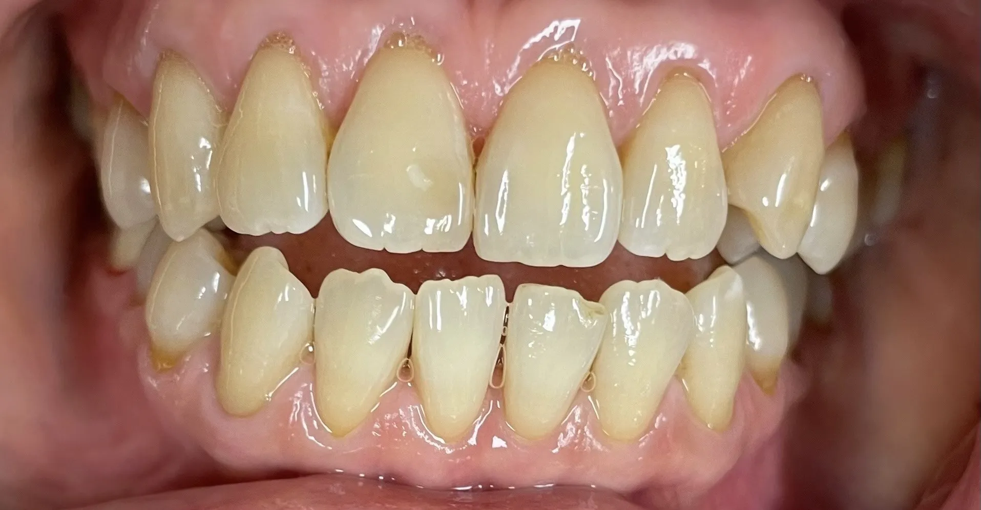 Crestview Family Dental