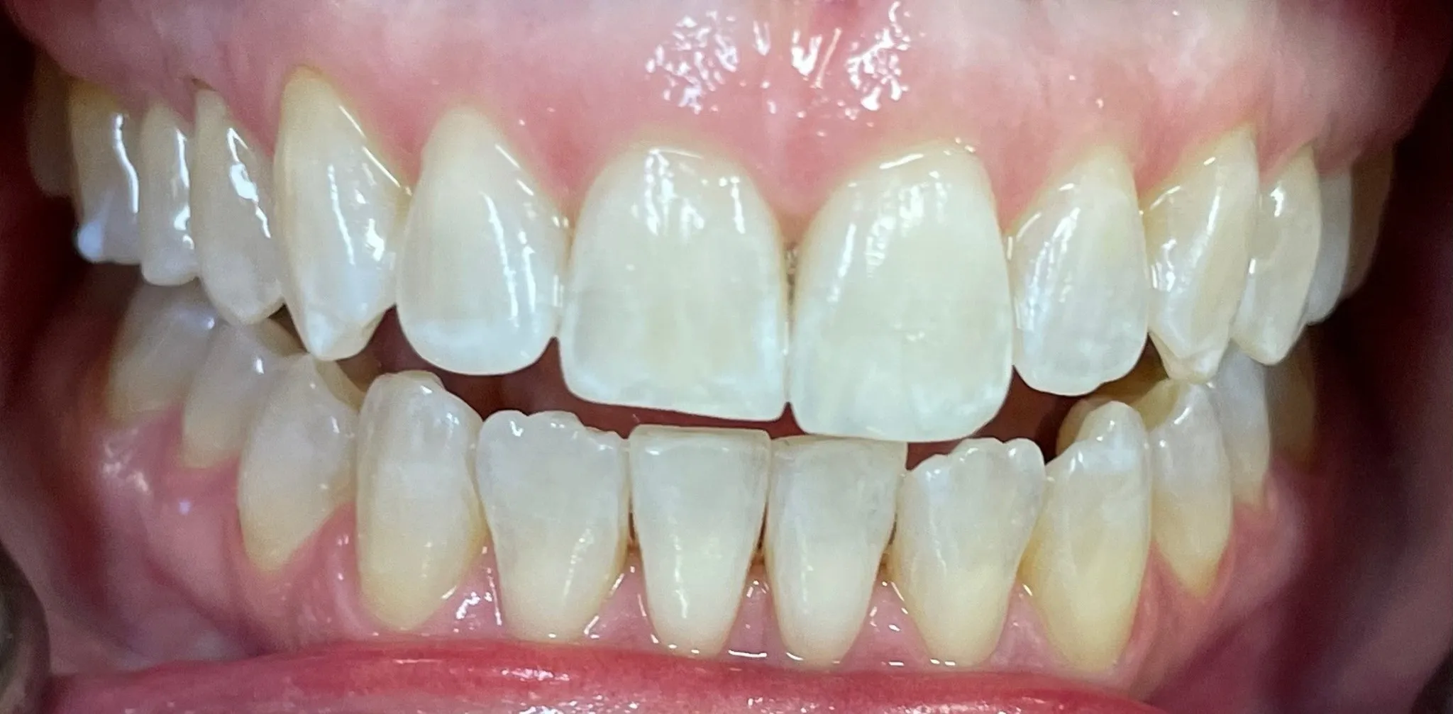 Crestview Family Dental