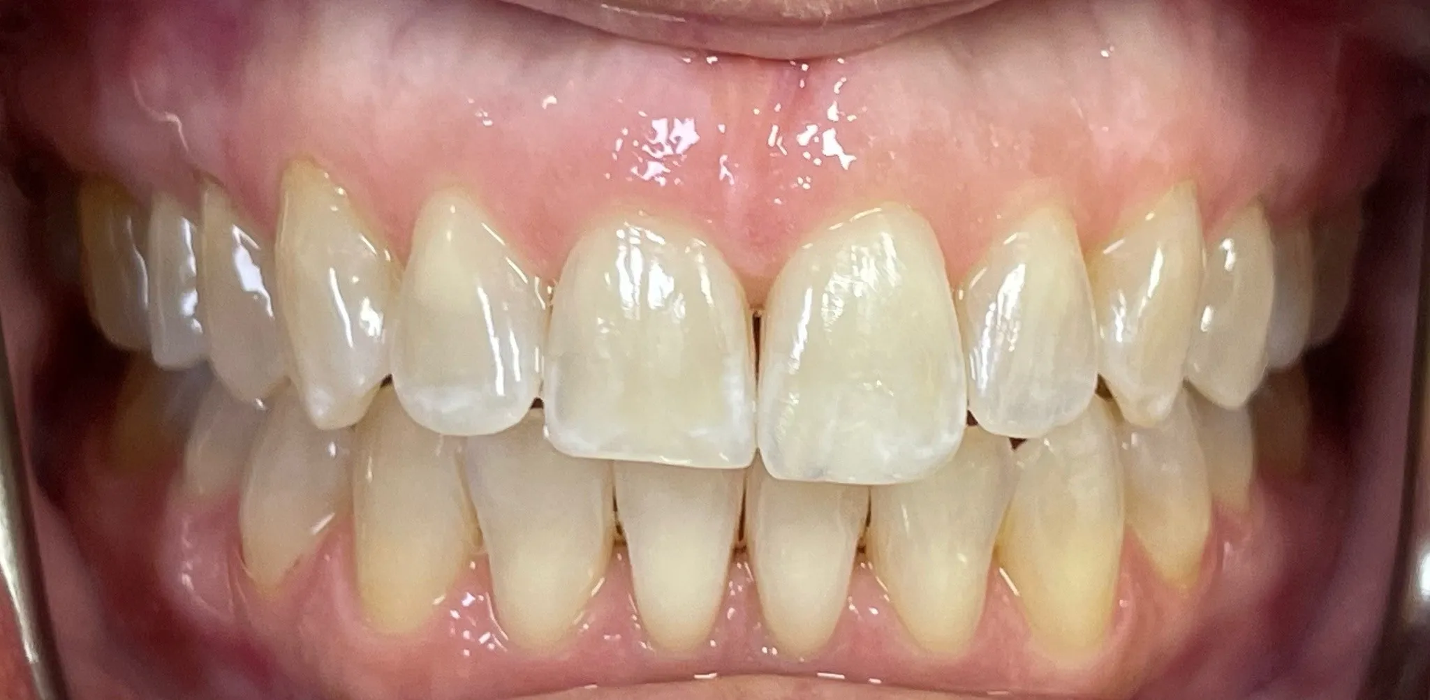 Crestview Family Dental