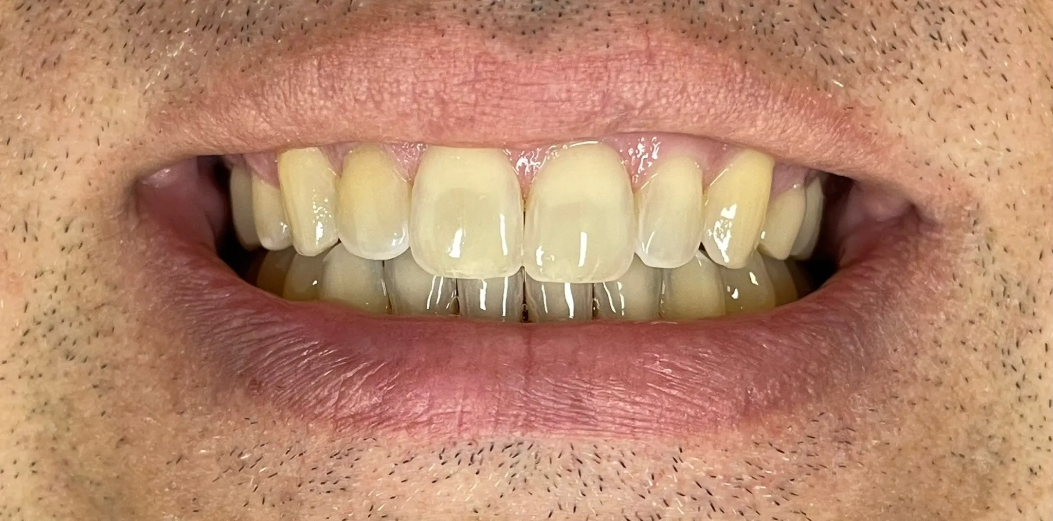 Crestview Family Dental