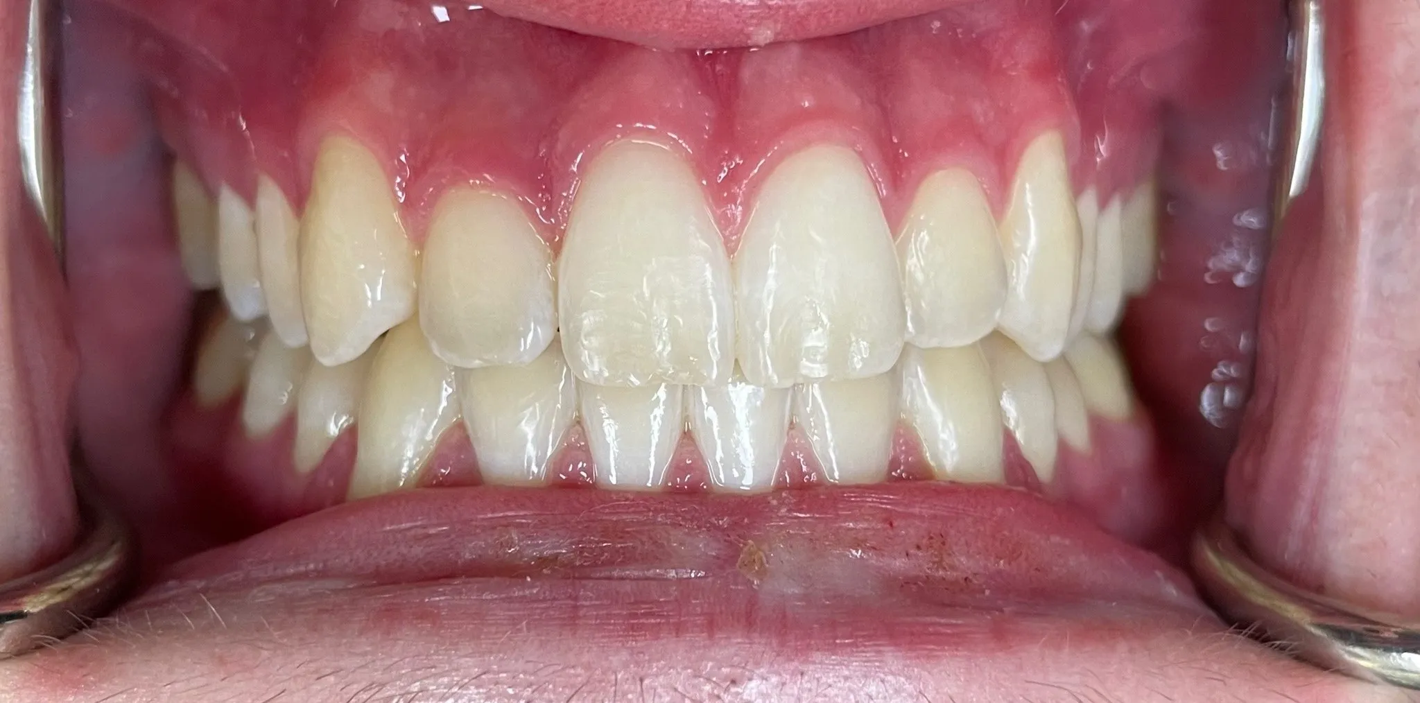 Crestview Family Dental