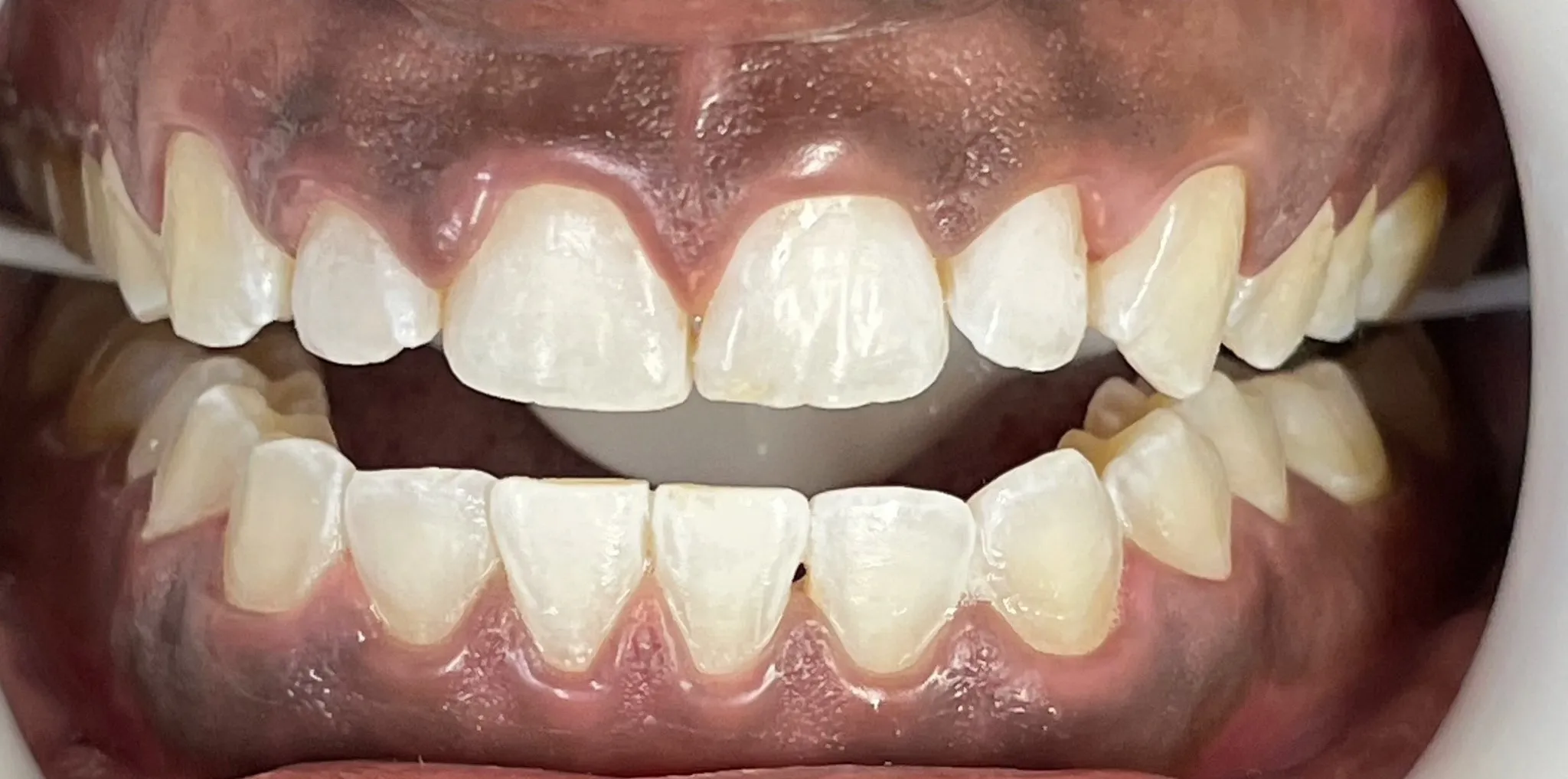 Crestview Family Dental