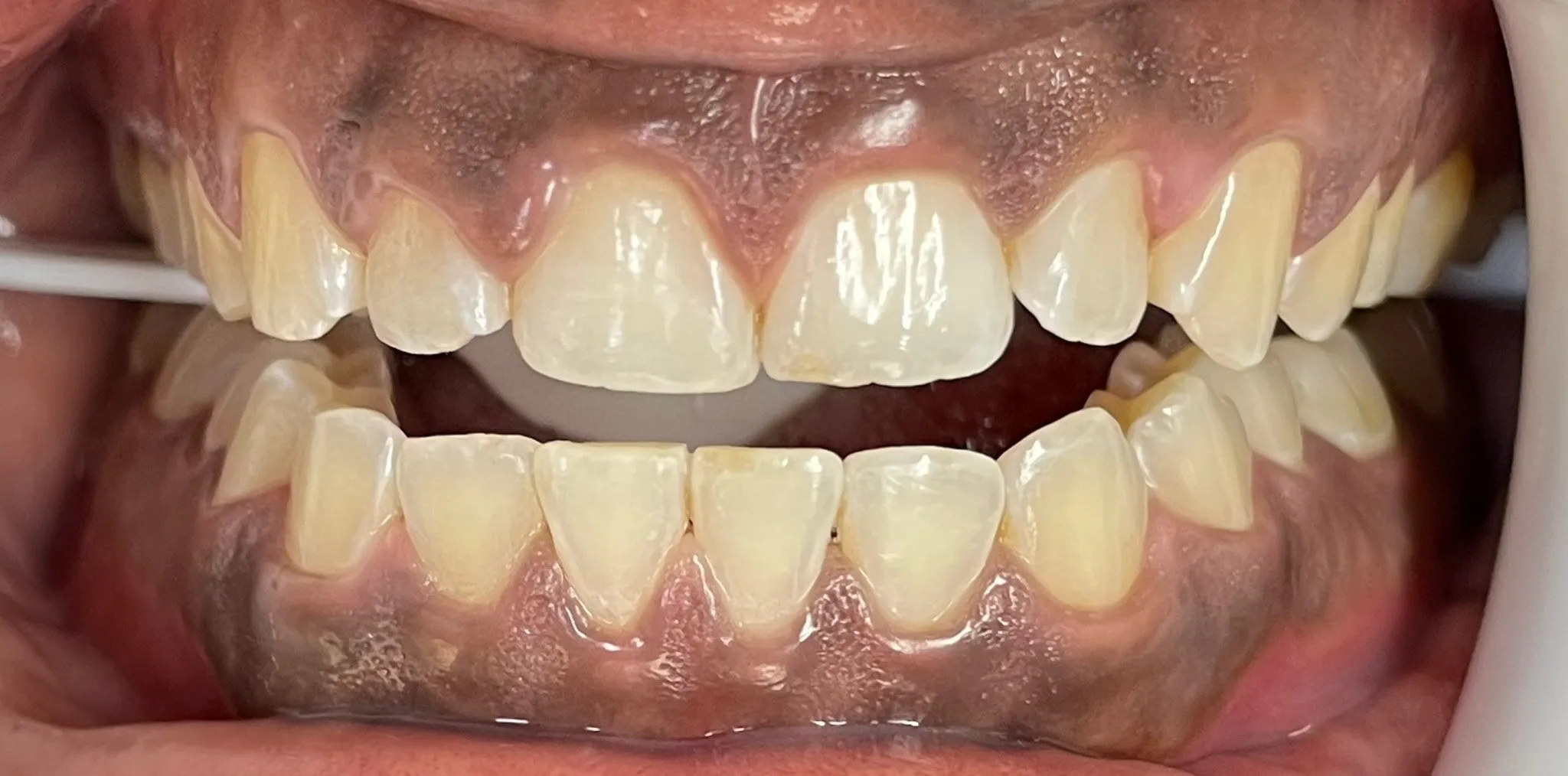 Crestview Family Dental